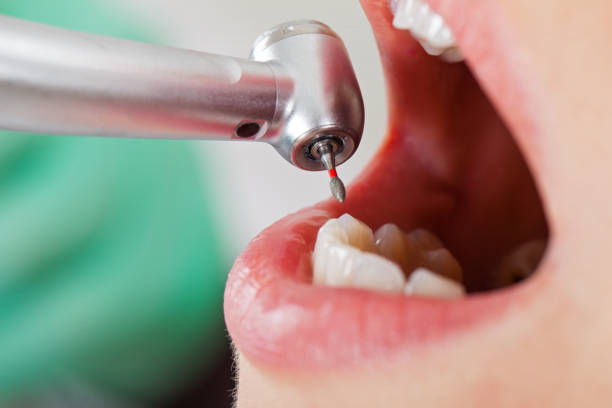 Best Emergency Cosmetic Dentistry (e.g., broken veneers) in Dickson, OK